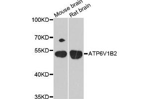 Western blot analysis of extracts of mouse brain and rat brain cell lines, using ATP6V1B2 antibody. (ATP6V1B2 anticorps)