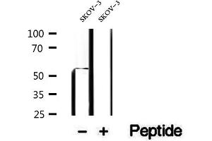 Western blot analysis of extracts of SKOV-3 cells, using PDHX antibody. (PDHX anticorps)