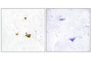Immunohistochemistry analysis of paraffin-embedded human brain tissue, using EZH1 antibody. (EZH1 anticorps  (Internal Region))