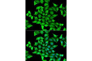 Immunofluorescence analysis of HeLa cells using SEPSECS antibody (ABIN2559867). (SEPSECS anticorps)