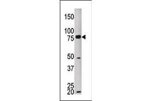 The anti-MELK Pab (ABIN391224 and ABIN2841298) is used in Western blot to detect MKEL in HEPG2 tissue lysate (MELK anticorps  (C-Term))