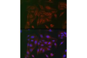 Immunofluorescence analysis of U2OS cells using IL6ST antibody (ABIN7268003) at dilution of 1:100.