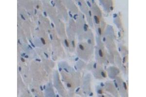 Figure. (ANKRD1 anticorps  (AA 5-279))