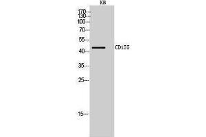 Western Blotting (WB) image for anti-Poliovirus Receptor (PVR) (Internal Region) antibody (ABIN3178974) (Poliovirus Receptor anticorps  (Internal Region))