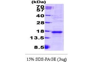 SDS-PAGE (SDS) image for Vascular Endothelial Growth Factor (VEGF) (AA 205-324) protein (His tag) (ABIN667747) (VEGF Protein (AA 205-324) (His tag))