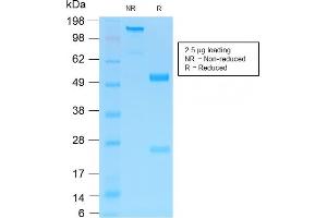 SDS-PAGE Analysis Purified NGFR Rabbit Recombinant Monoclonal Antibody (NGFR/1997R).