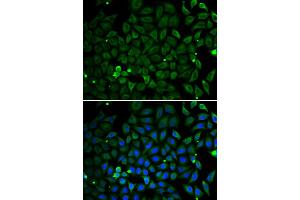 Immunofluorescence analysis of U2OS cell using PARK2 antibody. (Parkin anticorps)