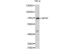 Western blot analysis of extracts of HeLa cells, using SPOP antibody (ABIN6292286) at 1:3000 dilution. (SPOP-B anticorps)