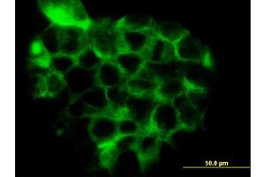 Immunofluorescence of monoclonal antibody to RRAS2 on A-431 cell.