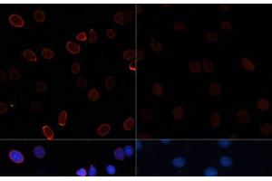 Immunofluorescence analysis of C6 cells using Acetyl-Histone H3-K56 Polyclonal Antibody at dilution of 1:100. (Histone 3 anticorps  (acLys56))