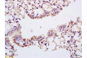 Formalin-fixed and paraffin embedded mouse lung labeled with Rabbit Anti Phospho-TrkA (Tyr490) /TrkB (Tyr516) Polyclonal Antibody, Unconjugated (ABIN746603) at 1:200 followed by conjugation to the secondary antibody and DAB staining