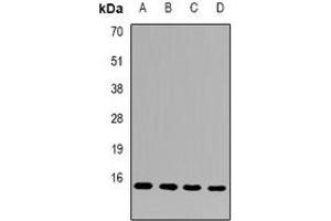 Western blot analysis of FAM96B expression in Hela (A), MCF7 (B), mouse heart (C), mouse testis (D) whole cell lysates. (FAM96B anticorps)