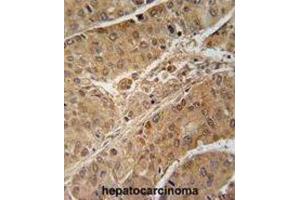 Immunohistochemistry (IHC) image for anti-Ribosomal Protein S6 Kinase, 70kDa, Polypeptide 2 (RPS6KB2) antibody (ABIN2909954)