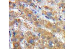 IHC-P analysis of Liver tissue, with DAB staining. (SERPINA1 anticorps  (AA 25-413))