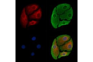 ABIN6265683 and ABIN6278367 staining Hela cells by IF/ICC. (TPBG anticorps  (C-Term))