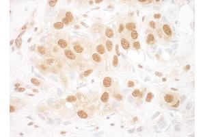Immunohistochemistry (IHC) image for anti-RuvB-Like 2 (E. Coli) (RUVBL2) (AA 1-50) antibody (ABIN7454837)