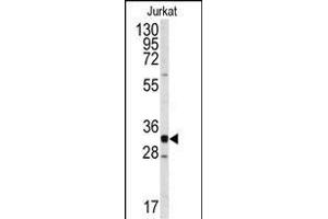 Western blot analysis of anti-CDK2 Antibody (C-term) (ABIN391746 and ABIN2841622) in Jurkat cell line lysates (35 μg/lane). (CDK2 anticorps  (C-Term))