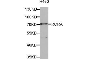 Western blot analysis of extracts of H460 cells, using RORA antibody.
