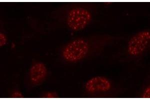 Immunofluorescence analysis of methanol-fixed HeLa cells using Phospho-MAPKAPK2(T334) Polyclonal Antibody