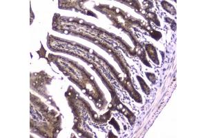 IHC testing of FFPE mouse small intestine tissue with Glutathione Reductase antibody at 1ug/ml. (Glutathione Reductase anticorps)