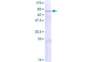 Image no. 1 for UDP-Gal:betaGlcNAc beta 1,3-Galactosyltransferase, Polypeptide 2 (B3GALT2) (AA 1-422) protein (GST tag) (ABIN1346274)