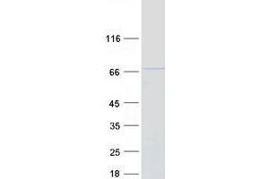 Validation with Western Blot