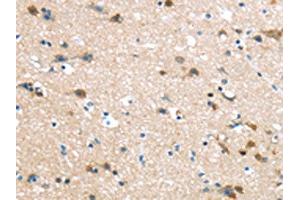 The image on the left is immunohistochemistry of paraffin-embedded Human brain tissue using ABIN7190906(HAUS7 Antibody) at dilution 1/30, on the right is treated with synthetic peptide. (HAUS7 anticorps)