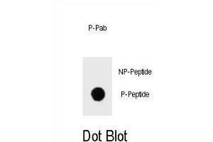 Dot blot analysis of Phospho-IKKB- Antibody Phospho-specific Pab (ABIN1539709 and ABIN2839874) on nitrocellulose membrane. (IKBKB anticorps  (pSer675))