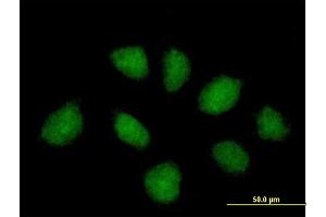 Immunofluorescence of purified MaxPab antibody to C1orf164 on HeLa cell.
