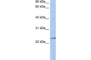 WB Suggested Anti-ATP6V1E2 Antibody Titration: 0. (ATP6V1E2 anticorps  (Middle Region))