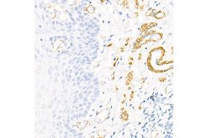 Immunohistochemistry of paraffin-embedded human colon using Decorin Rabbit pAb (ABIN3022360, ABIN3022361, ABIN3022362, ABIN1512816 and ABIN6218761) at dilution of 1:50 (40x lens).