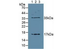 Western blot analysis of (1) Human Placenta Tissue, (2) Human PC-3 Cells and (3) Human MCF7 Cells. (Ki-67 anticorps  (AA 3088-3235))
