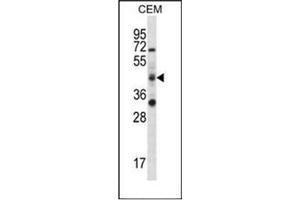 Western blot analysis of RBM42 Antibody (C-term) in CEM cell line lysates (35ug/lane). (RBM42 anticorps  (C-Term))