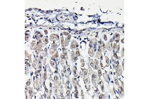 Immunohistochemistry of paraffin-embedded mouse stomach using PFKFB3 Rabbit pAb (ABIN6129841, ABIN6145485, ABIN6145487 and ABIN6222692) at dilution of 1:25 (40x lens). (PFKFB3 anticorps  (AA 400-500))