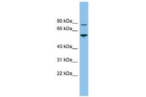 VPS52 antibody used at 1 ug/ml to detect target protein. (VPS52 anticorps)