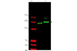 Western blot using  affinity purified anti-Gli-2 antibody shows detection of Gli-2 protein in rat testes (lane 1) and human HEK293 (lane 2) whole cell lysates (arrowhead). (GLI2 anticorps  (Internal Region))