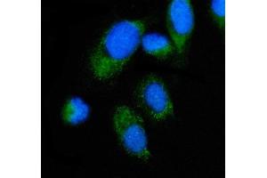 IF analysis of ALAS2/ASB using anti-ALAS2/ASB antibody (ABIN7599056). (ALAS2 anticorps  (AA 1-190))