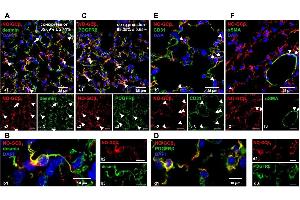 NO-GC expression in the murine lung.