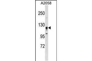 Western blot analysis in A2058 cell line lysates (35ug/lane). (STK31 anticorps  (N-Term))