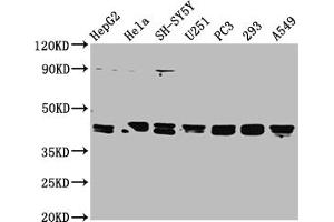 Western Blot Positive WB detected in: HepG2 whole cell lysate, Hela whole cell lysate, SH-SY5Y whole cell lysate, U251 whole cell lysate, PC-3 whole cell lysate, 293 whole cell lysate, A549 whole cell lysate All lanes: TPST1 antibody at 1:2000 Secondary Goat polyclonal to rabbit IgG at 1/50000 dilution Predicted band size: 43 kDa Observed band size: 43 kDa (TPST1 anticorps  (AA 283-370))