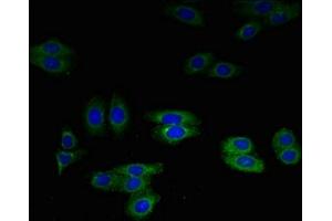 Immunofluorescent analysis of HepG2 cells using ABIN7144333 at dilution of 1:100 and Alexa Fluor 488-congugated AffiniPure Goat Anti-Rabbit IgG(H+L)