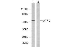 Western blot analysis of extracts from LOVO cells using ATF-2(Ab-69 or 51) antibody (E021030). (ATF2 anticorps)