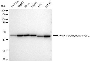 Western blotting analysis using Acetyl-CoA acyltransferase 2 antibody (ABIN7797441).