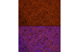 Immunofluorescence analysis of Human spleen using CCL5/RANTES antibody (ABIN6129369, ABIN6138063, ABIN6138065 and ABIN6218473) at dilution of 1:100.