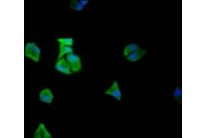 Immunofluorescence staining of Hela Cells with ABIN7127469 at 1:50, counter-stained with DAPI. (Recombinant EIF5A anticorps)