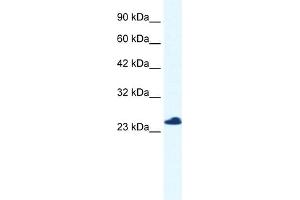 WB Suggested Anti-C14orf166 Antibody Titration:  0. (C14orf166 anticorps  (N-Term))