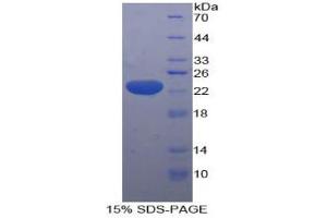 SDS-PAGE analysis of Human HMGCS Protein.