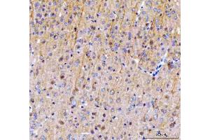 IHC analysis of SAMSN1 using anti-SAMSN1 antibody (ABIN7602721).