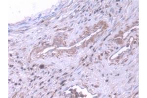 Detection of NME5 in Human Prostate Tissue using Polyclonal Antibody to Non Metastatic Cells 5, Protein NM23A Expressed In (NME5) (NME5 anticorps  (AA 3-194))