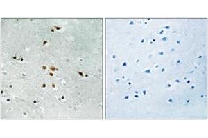 Immunohistochemistry analysis of paraffin-embedded human brain, using FER (Phospho-Tyr402) Antibody.